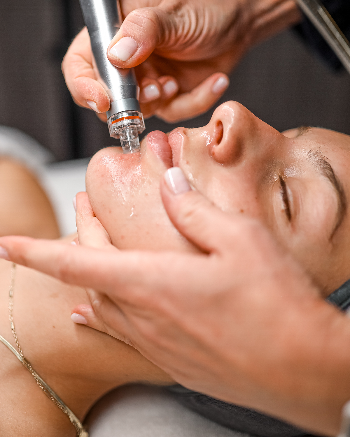 (New) Spalina CO2 Plasma Renewal Facial Series