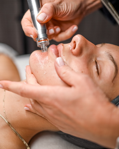 (New) Spalina CO2 Plasma Renewal Facial Series